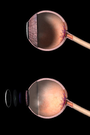 Medical Details - Human Eye